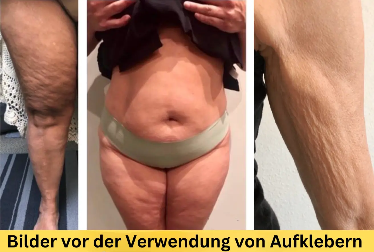 bilder-vor-der-verwendung-von-aufklebern.png (1) bilder-vor-der-verwendung-von-aufklebern.png (1)